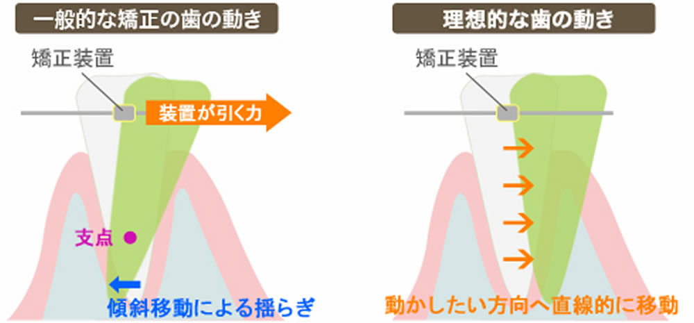 3D-LST