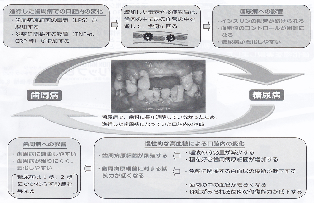 負のスパイラル構造