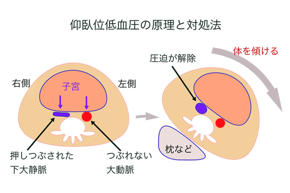 サンプルイメージ